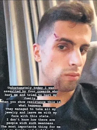 hirsizlarin-yeni-hedefleri-futbolcular-oldu-saldiriya-ugrayanlar-kervanina-joao-cancelo-da-katildi-1640981759698.jpeg Hırsızların yeni hedefleri futbolcular oldu! Saldırıya uğrayanlar kervanına Joao Cancelo da katıldı!-2