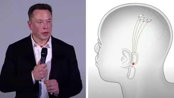 Elon Musk insanlara çip takacak: Neuralink çip tartışma konusu-11