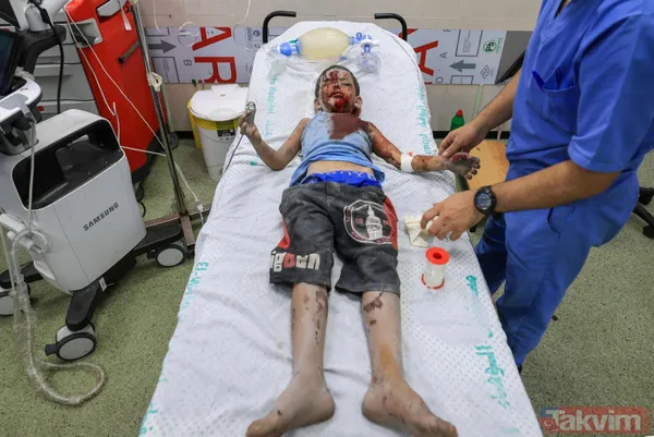 Dikkat!+18 | ABD'den soykırıma kalkan el! İşte işgalci İsrail'in Gazze'de uyguladığı katliamdan vahşet kareleri - 22