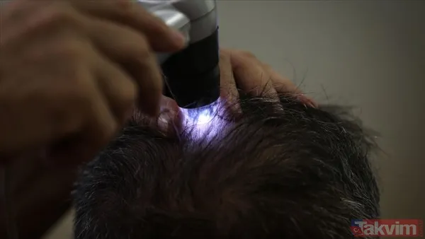 Yeni Bir Trend: Hızlı, Güvenli, Doğal Saç Sistemleri Artık Sadece Johnny'nin Değil, Binlerce Erkeğin Tercihi Haline Geldi. Saç Sistemlerinin Satışları...