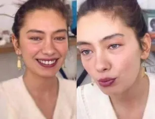 Neslihan Atagül eridi bitti! İşte son hali...