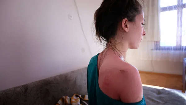 esinin-sicak-su-dokerek-hasladigi-rukiye-ayin-yurek-yakan-sozleri-bana-abla-diyor-1611992010392.jpg Eşinin sıcak su dökerek haşladığı Rukiye Ay'ın yürek yakan sözleri: Bana abla diyor-7