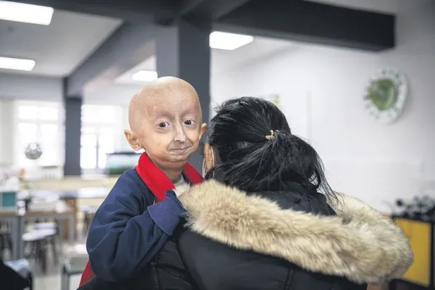 akondroplazi-tanisiyla-mucadele-veren-metehan-bebek-saglik-bakanliginin-voxzogo-adli-ilac-sayesinde-umudu-artt-1643670504080.jpeg Akondroplazi tanısıyla mücadele veren Metehan Bebek Sağlık Bakanlığı’nın “Voxzogo” adlı ilaç sayesinde umudu arttı-17