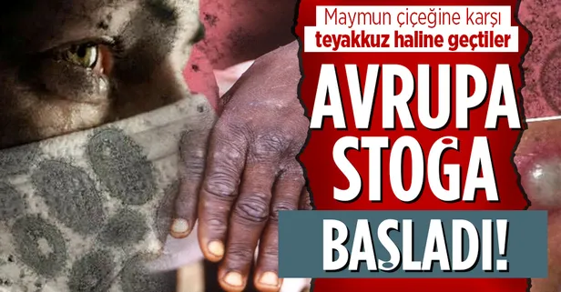 Koronavirüsün ardından şimdi de maymun çiçeği virüsü paniği yaşanıyor! Aşı stokları yapıldı, 21 gün karantina...