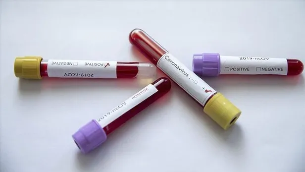 ingiliz-bilim-insanlarindan-koronavirus-raporu-damari-tikiyor-akciger-ve-kalbi-vuruyor-beyni-bitiriyor-1606432979588.jpeg İngiliz bilim insanlarından koronavirüs raporu: Damarı tıkıyor, akciğer ve kalbi vuruyor, beyni bitiriyor-1