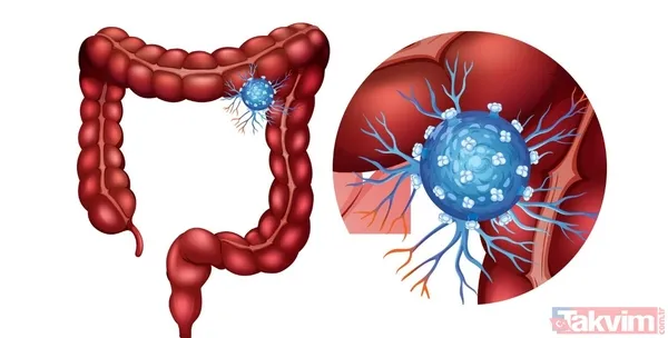 Doğal iştah kapatıcı lif: Uzman Emma Bardwell kolon kanseri riskini azaltan ve zayıflatan besinleri açıkladı - 3