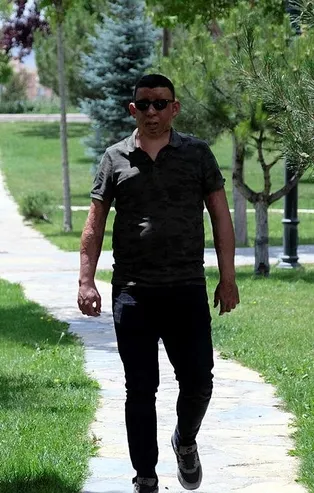 Vücudunun büyük bir bölümü yanan Gökhan Baran'ın hayatı, Başkan Erdoğan'ın talimatıyla değişti