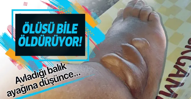 Ayağına düşen 'aslan balığı' öldürüyordu