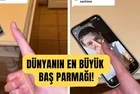 Tiktok fenomeni dünyanın en büyük başparmağına sahip! Bu yüzden telefon bile kullanamıyor