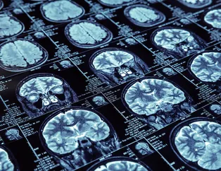 Bir haftada yüzde 40 daha zeki olmak mümkün!