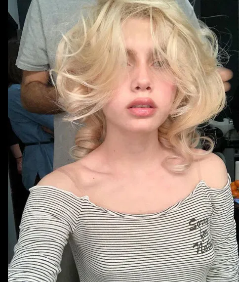 Aleyna Tilki yüzüne ne yaptırdı?-3