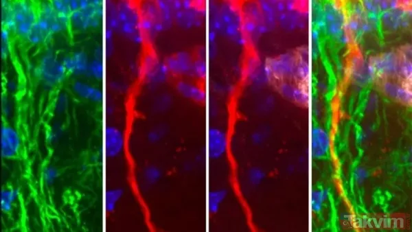 Alzheimer için yeni umut: Bilim insanları zehirli proteini temizleyen hücreler keşfetti - 2