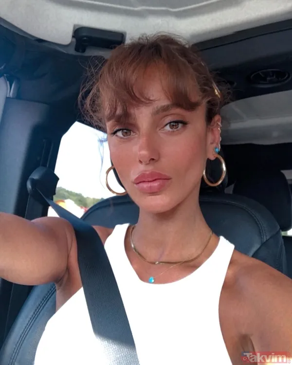 Bestemsu Özdemir estetik açıklamasıyla sosyal medyanın diline düştü! Eski hali olay oldu! “İhtiyaç duymadım...” - 4