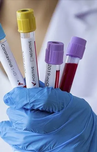 600 milyon aşı üretilecek