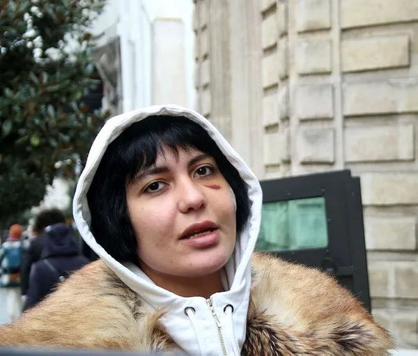 Saldırı sonrası ilk kez görüntülendi! Bahar Candan'ın yüzüne 10 dikiş atıldı - 2