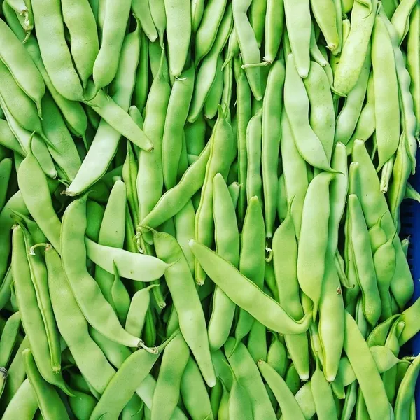 Kalp krizini önceden tespit edebilen görüntüleme yöntemi geliştirildi (Sağlık haberleri)-1