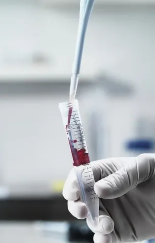 Eskişehir'de inanılmaz olay! “Kanım şifa” diyerek insanlara kanını içirmiş