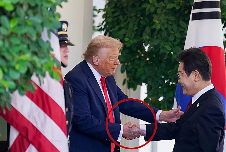 Trump’ın elindeki morluğun sebebi ne?