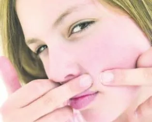 Sivilce psikoloji bozuyor!