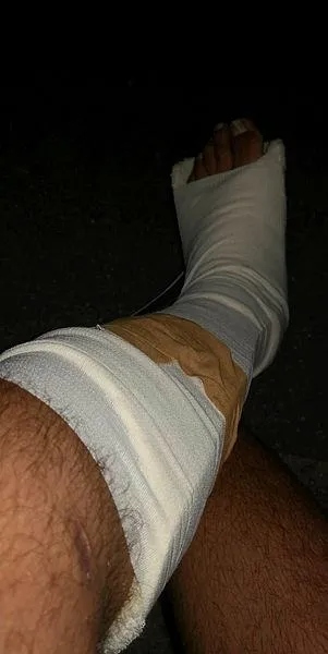 Almanya'da bir Türk'e polis köpeği ile şiddet-4