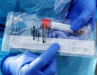 Plastik yüzeyde 3 gün yaşıyor!