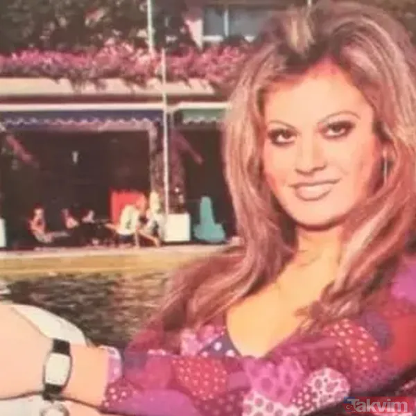 Yeşilçam'ın Bayan Bacak'ı Serpil Örümcer’den korkutan haber! “Ayağımın kesilme riski var” - 3