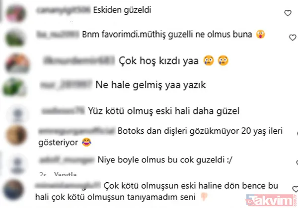 Kısmetse Olur Ayça son haliyle şaşırttı: Ne hale gelmiş! - 3