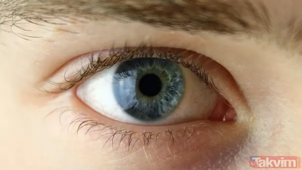 Yaşlılık Hastalığı Genç Bir Kadını Vurdu Deborah Cobb'a, Genellikle Yaşlılık Ve Genetik Faktörlere Bağlı Olarak Ortaya Çıkan Makula Dejenerasyonu Teşhisi Kondu...