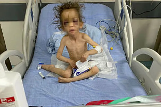 Gaziantep'te skandal olay! Cani anne 5 yaşındaki çocuğuna işkence yapıp aç bırakmış! O cani anne tutuklandı