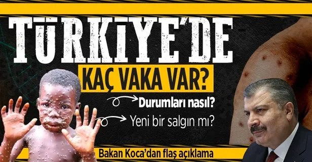 Sağlık Bakanı Fahrettin Koca’dan maymun çiçeği açıklaması! Türkiye’de kaç vaka var? Maymun çiçeği nasıl bulaşır, belirtileri neler?