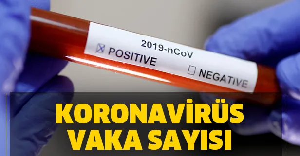 Corona virüs tablosu! 28 Nisan vaka, ölüm ve iyileşen hasta sayısı kaç oldu? Koronavirüs CANLI harita