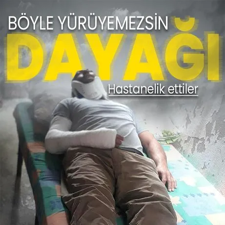 Adana’da husumetlilerden Böyle yürüyemezsin dayağı: Hastanelik ettiler