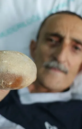 Samsun'da doktorları şoke eden olay: Görünce patates sandım