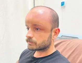 ’Ödem’üz koptu!