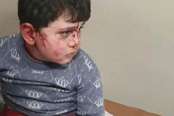 sputnikin-emreni-patronu-margarita-simonyan-turkleri-tehdit-etti-lavrovu-dinlemeseler-soyguyu-dinleyecekler-1602442400344.jpg Sputnik'in Ermeni Patronu Margarita Simonyan Türkleri tehdit etti: Lavrov'u dinlemeseler, Şoygu'yu dinleyecekler-4