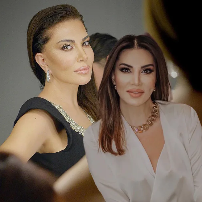 Yüz lifting yaptıran Ebru Yaşar’ın son hali olay oldu: İnsan bunu kendine nasıl yapar? - 11