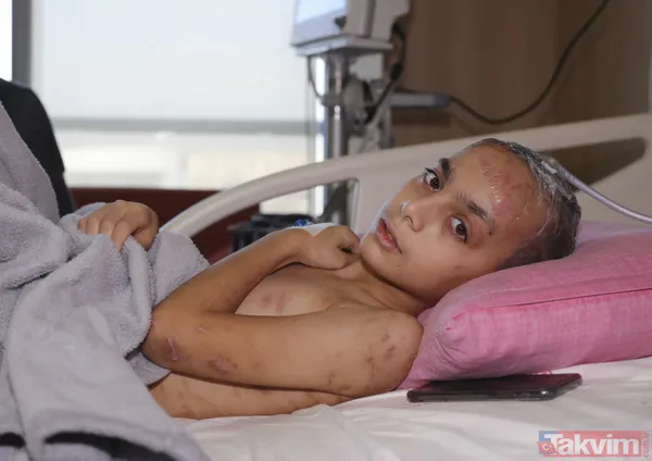 Ankara'da sokak köpeklerinin saldırısının ardından 9 ameliyat geçiren Enes Koca, yeniden yürümeye hazırlanıyor - 16