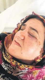 gaziantepte-sezay-kocak-cinayetinde-savcilik-intihar-dedi-ust-mahkeme-cinayet-olabilir-diyerek-yeni-sorusturma-1649193214553.jpeg Gaziantep'te Sezay Koçak cinayetinde savcılık intihar dedi! Üst mahkeme cinayet olabilir diyerek yeni soruşturma istedi-4