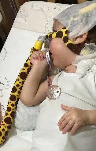 Avrupa hasta seçiyor Türkiye'de bütün SMA’lı çocuklara ilaç veriliyor