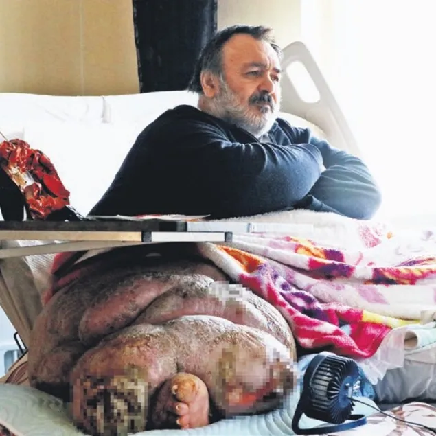 Tedavi için 12 milyon TL gerekli