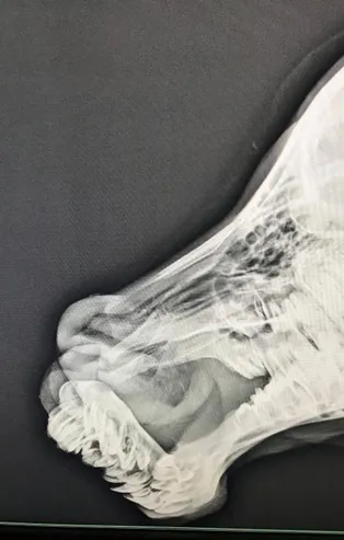 Son dakika: Batman'da anomali rahatsızlığı olan buzağıya "estetik" operasyonu