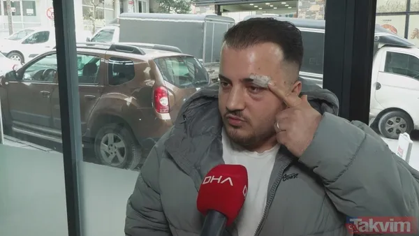 Eyüpsultan'da "yol verme" kavgası! Önce darbetti sonra tanımazlıktan geldi: Buyur kardeşim - 1