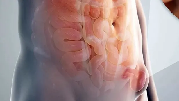 dr-nafiz-karagozoglu-degerlendirdi-isimiz-yas-1661028909224.jpeg Dr. Nafiz Karagözoğlu değerlendirdi: İşimiz yaş!-2