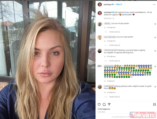 Seda Akgül'ü son haliyle tanımak imkansız! Neredeyse çocukluğuna dönen Seda'ya yorum yağdı: "Survivor Mert'in sevgilisi Sude sandım" - 4