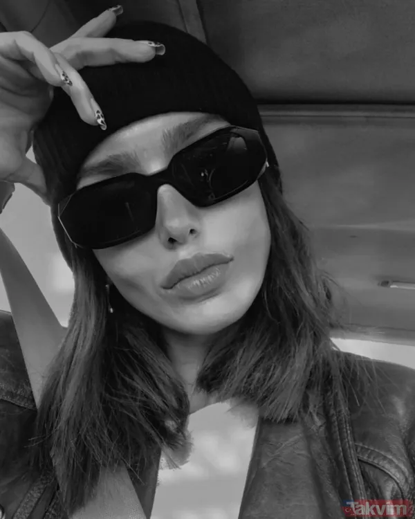 Bestemsu Özdemir estetik açıklamasıyla sosyal medyanın diline düştü! Eski hali olay oldu! “İhtiyaç duymadım...” - 3