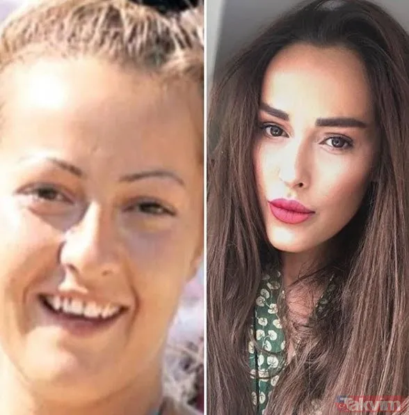 Hülya Avşar�ın kardeşi Helin Avşar tanınmaz halde! Son hali şaşkına
