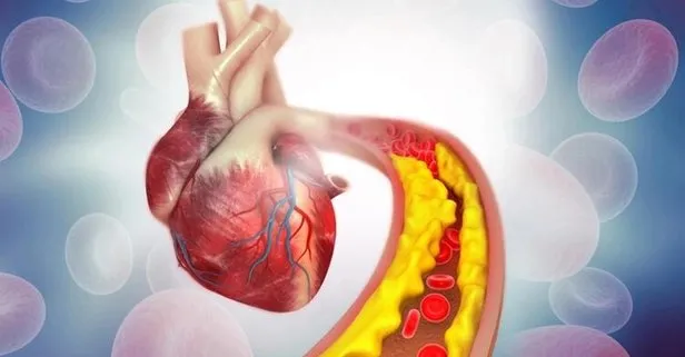 Uzmanlardan korkutan uyarı kolesterol kalbi bitiriyor