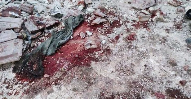 MSB’den Afrin’de hastaneye düzenlenen saldırıya ilişkin açıklama: PKK/YPG’ye ait hedefler derhal ateş altına alındı