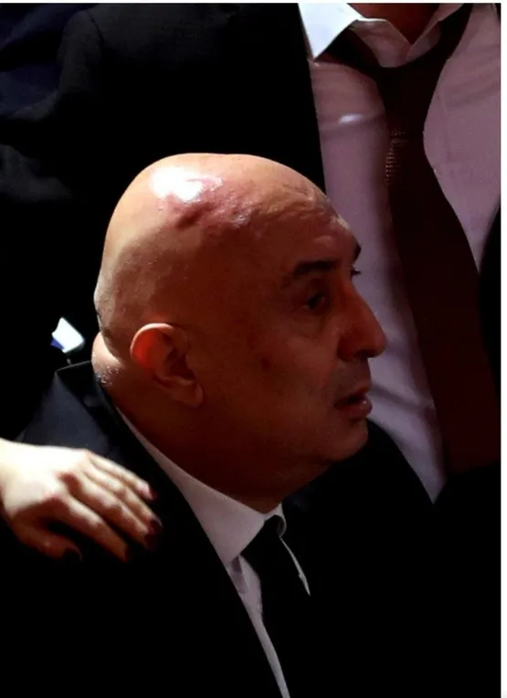 mecliste-chp-provokasyonu-iste-ozkocun-son-hali-1583348328376.jpeg Meclis’te CHP provokasyonu! İşte Özkoç’un son hali-1