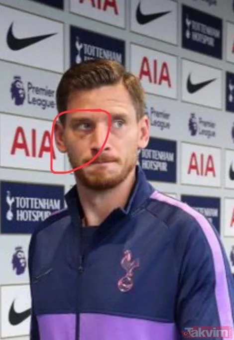 Bu kez aldatma haberi İngiltere'den geldi! Tottenham fena karıştı, yumruklar havalarda uçuştu - 7